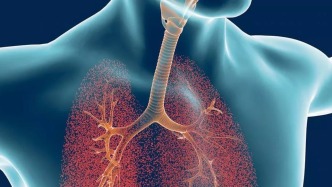 慢阻肺病被納入國(guó)家基本公衛(wèi)，對(duì)近億患者和藥企意味著什么？