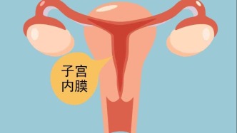 張云霄：月經不調能吃膏方調理嗎？