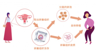 卵巢冷冻移植的那些事