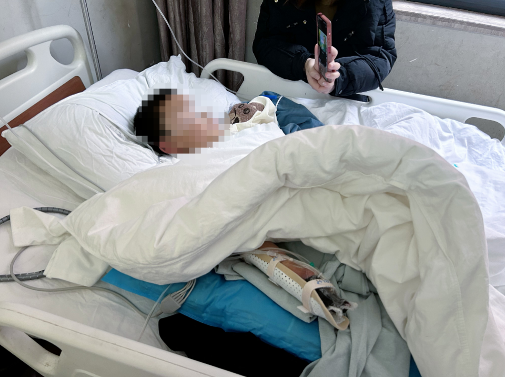 10岁男童玩未燃尽礼花右手被炸伤，医生：三个手指缺损