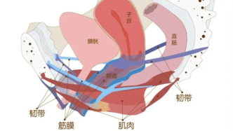 子宫脱垂漏尿多年后，她在89岁遇良医