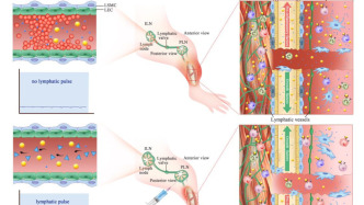 上海學(xué)者在中醫(yī)理論指導(dǎo)下有新發(fā)現(xiàn)：淋巴管血小板栓延緩骨折修復(fù)