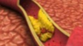 血脂高不高，从读懂你的化验报告单开始