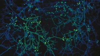 真菌如何改变地球的“公路”网络