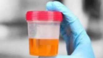 尿白蛋白检测：肾脏健康的“信号灯”