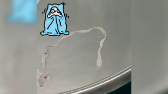 疑因吃了未煮熟的青蛙，16岁少女脑内藏寄生虫多年