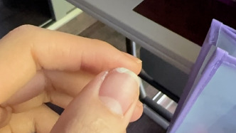 運動員賈一凡被粉絲擠斷指甲，發文呼吁要理智追星