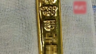 11歲男孩把100克金條吞入腹中，醫生手術取出