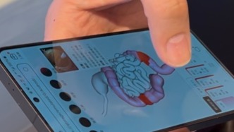 上海中山醫(yī)院發(fā)布內(nèi)鏡AI：可解讀胃腸鏡報(bào)告，也是手術(shù)伙伴