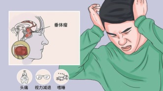 經(jīng)鼻內(nèi)鏡垂體瘤手術(shù)的“守門人”：腦脊液漏防治的硬核技術(shù)