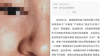 “可復美”被指違規添加表皮生長因子，陜西省藥監局：未檢出