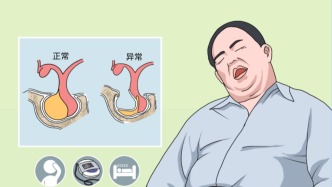 微创攻坚：紧贴颈内动脉的空蝶鞍垂体瘤手术纪实