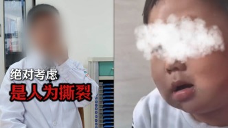 兒科醫生稱接診的3歲男童疑遭虐待，杭州警方：事發外地，嫌疑人已被當地警方控制