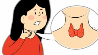 為什么結節會“盯上”女性？