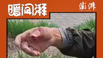裝修工人手部受傷，外賣小哥緊急送醫婉拒酬謝