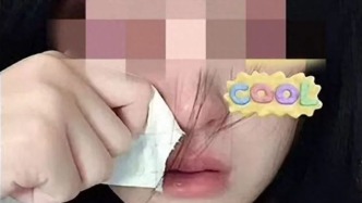 对话哭泣照被恶意盗用成“高潮针”配图女生：难过又屈辱