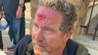 美記者報道洛杉磯騷亂被警察一槍射中腦門，警方回應：無可奉告