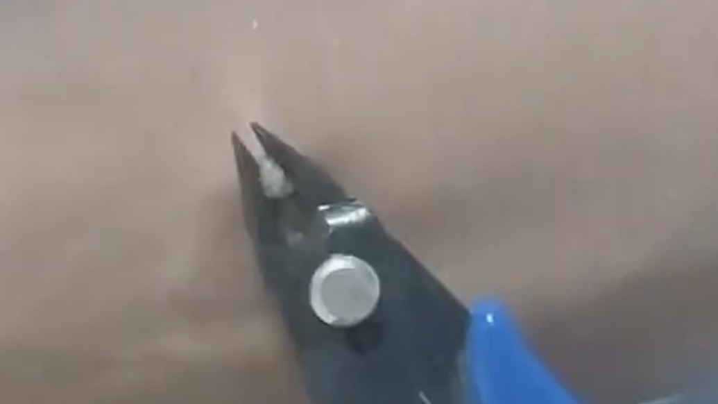 男子胳膊上长刺猴，自己竟用钳子硬生生拔掉