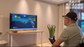 我國成功開展首例侵入式腦機接口臨床試驗
