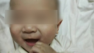 黑龍江伊春5月齡嬰兒確診罕見(jiàn)?。汗撬枰浦操M(fèi)30萬(wàn)，盼救助