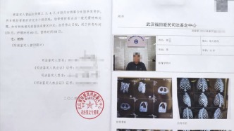 男子稱被交警打斷9根肋骨未立案警方否認(rèn)毆打，湖北云夢縣紀(jì)委：已介入處理