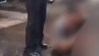 41歲男子持水果刀刺擔架上男子，武漢警方：因糾紛行兇