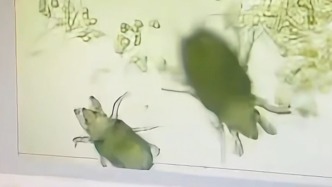 显微镜下发现毕业作品惨遭螨虫啃食，女生心态崩了