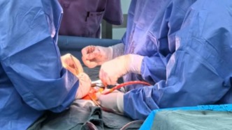 让心脏病患儿免于反复开胸换机械瓣，专家为其植入“活”的瓣膜