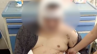 女子称丈夫搭救朋友被砍伤致死，嫌疑人被鉴定为抑郁症