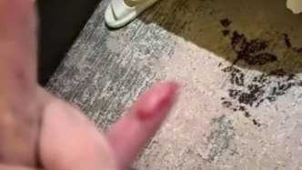 蜈蚣爬床咬傷住客手指，酒店：可能是窗戶沒關好
