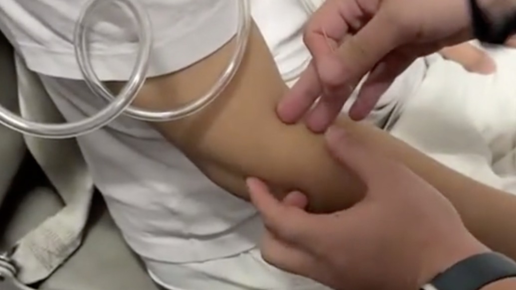 19歲少年萬米高空突發(fā)急癥,兩中醫(yī)針灸化險為夷