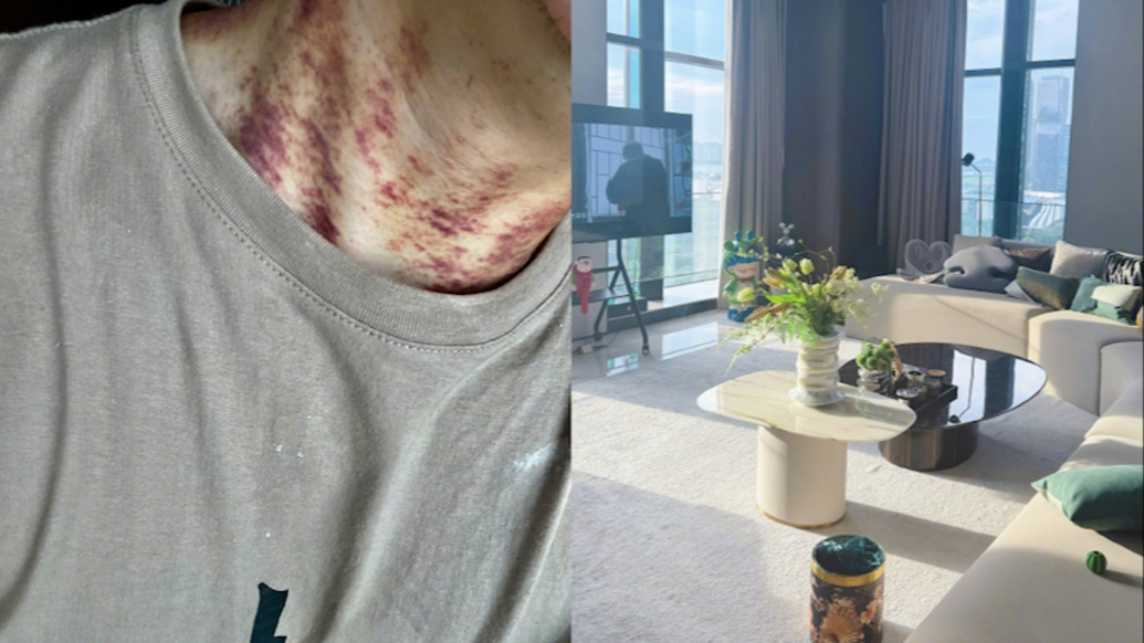 博主稱住月租6萬(wàn)“甲醛房”致患病，房東合伙人：多名租戶住過(guò)無(wú)異常