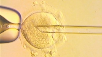 8名“三親嬰兒”誕生，原核移植技術(shù)能否改變遺傳病宿命？