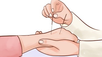 中西医结合治疗带你走出肋间神经痛的迷宫