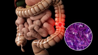 炎癥久拖易得癌癥，尤其是愛(ài)吃這幾類食物