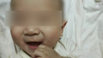 黑龍江6月齡嬰兒患罕見病續(xù)：獲多方幫助，將行骨髓移植手術(shù)