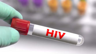 我國在艾滋病疫苗研發(fā)領(lǐng)域取得重要進(jìn)展