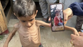 “6歲的孩子只有9公斤”，饑餓最先盯上加沙脆弱群體