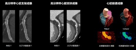 国产光子CT已入驻上海2家医院：高分辨率成像，可拍“彩色照片”