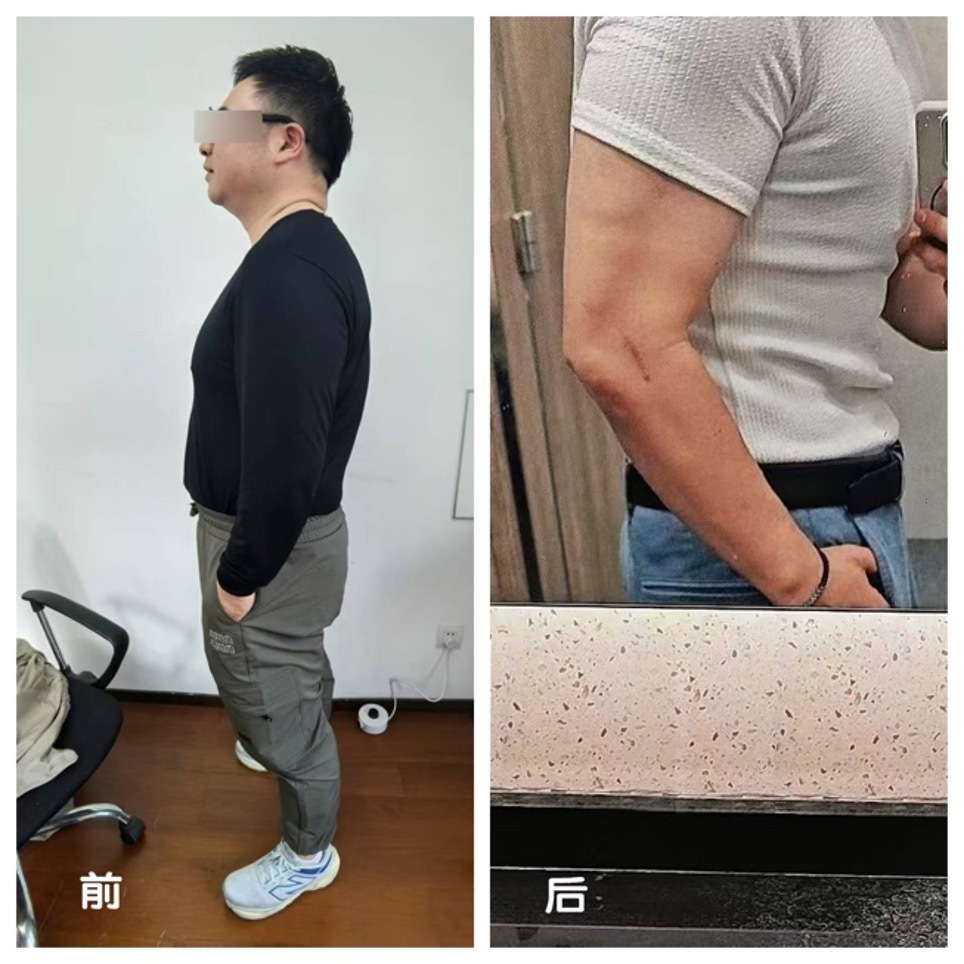 上海一医院举办减重大赛，冠军选手60天减重约30斤