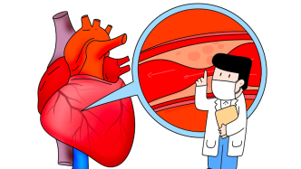 主動脈夾層——生命的定時炸彈