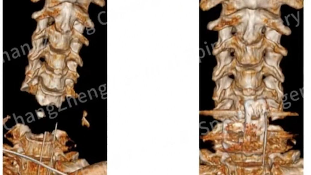 挑戰(zhàn)不可能！上海長征醫(yī)院醫(yī)生3小時救回“身首離斷”患者