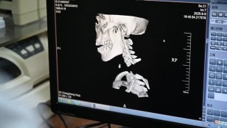 “在一個永不放棄的信念下”，上海醫(yī)生救回“身首離斷”患者