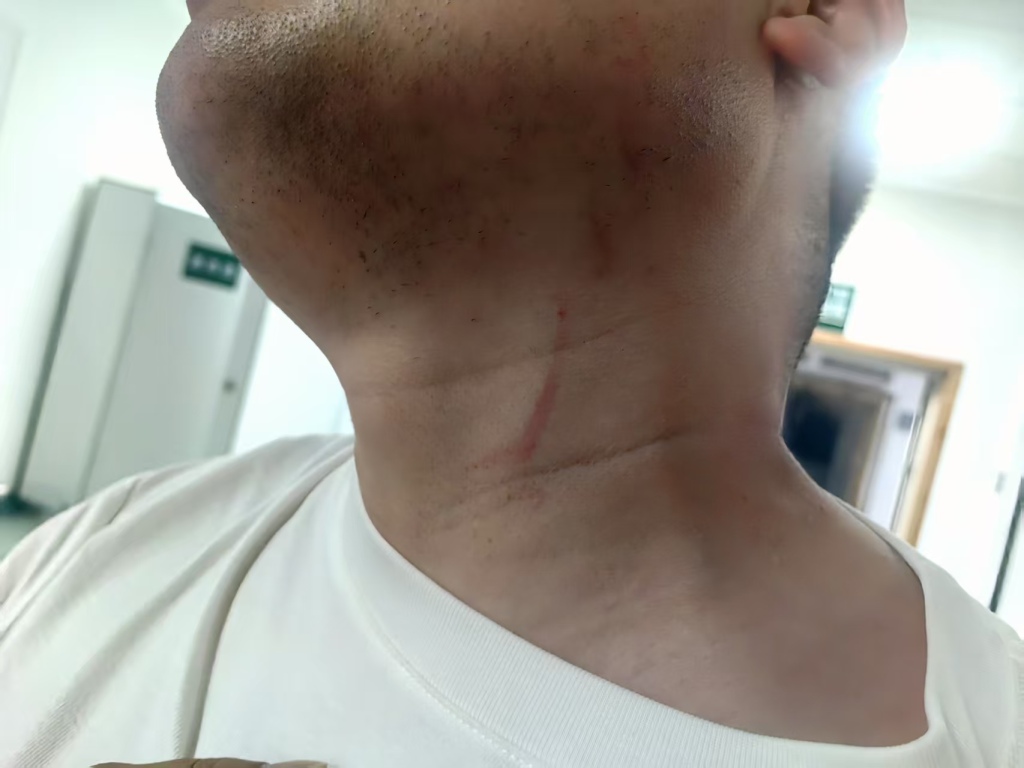 武汉一男子拍摄违章占道遭抢夺手机殴打，警方：不构成轻微伤，批评违章者并罚款500元