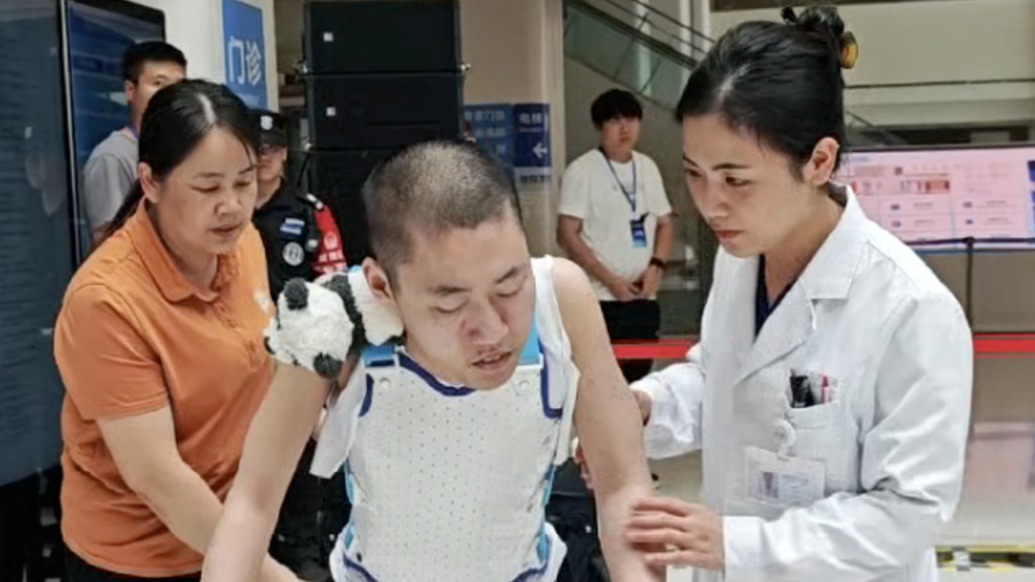 世界首例！“折疊男孩”經(jīng)歷4次手術(shù)能走路了，即將重返大學(xué)校園
