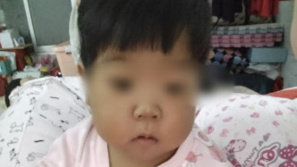 江西九江2歲肝衰兒救治續(xù)：愛心人士捐助，順利完成肝移植手術(shù)
