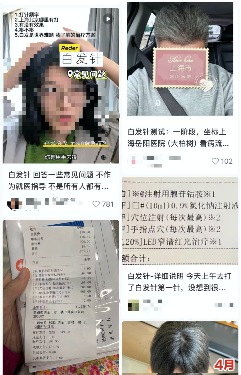 “白发针”靠谱吗？专家：没有明确研究证明治疗白发效果，需循证研究