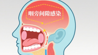 “小咽痛”險(xiǎn)要命！七旬老人命懸一線，一場(chǎng)手術(shù)搶回生機(jī)