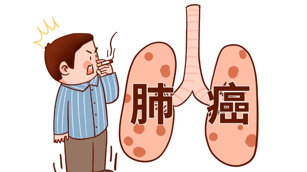 孙贤俊:肺癌转移有这些症状?