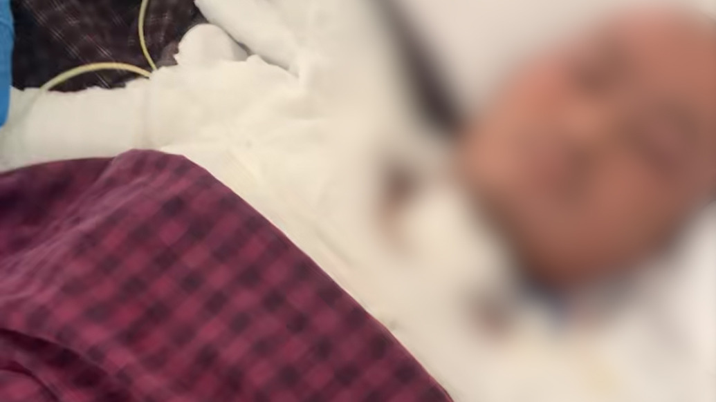 23歲小伙因煤氣泄漏閃爆全身95%燒傷，姐姐籌款進(jìn)度不足10%